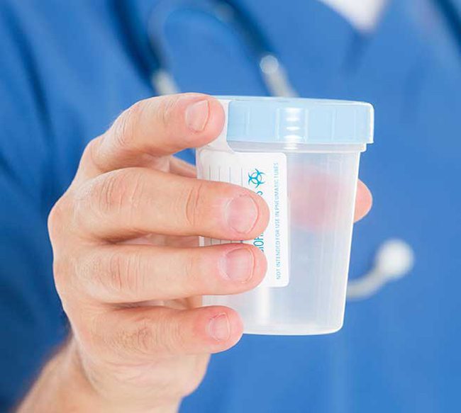 When to Perform a Direct Observation Specimen Collection